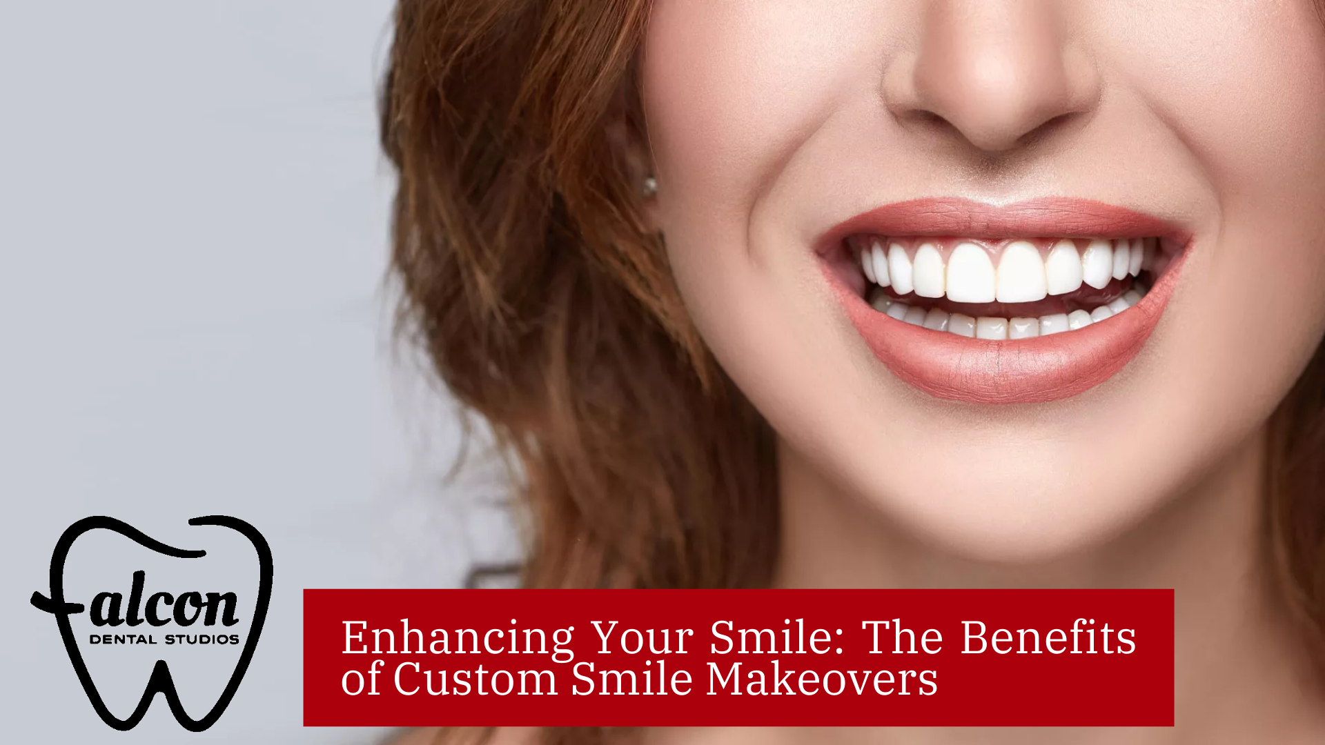 Enhancing Your Smile The Benefits of Custom Smile Makeovers